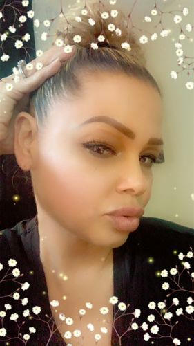 Customer photo review of WrinkleFix: Botox (First-Time)