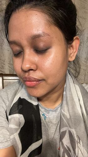 Customer photo review of The Glow Up | Dry Skin Kit