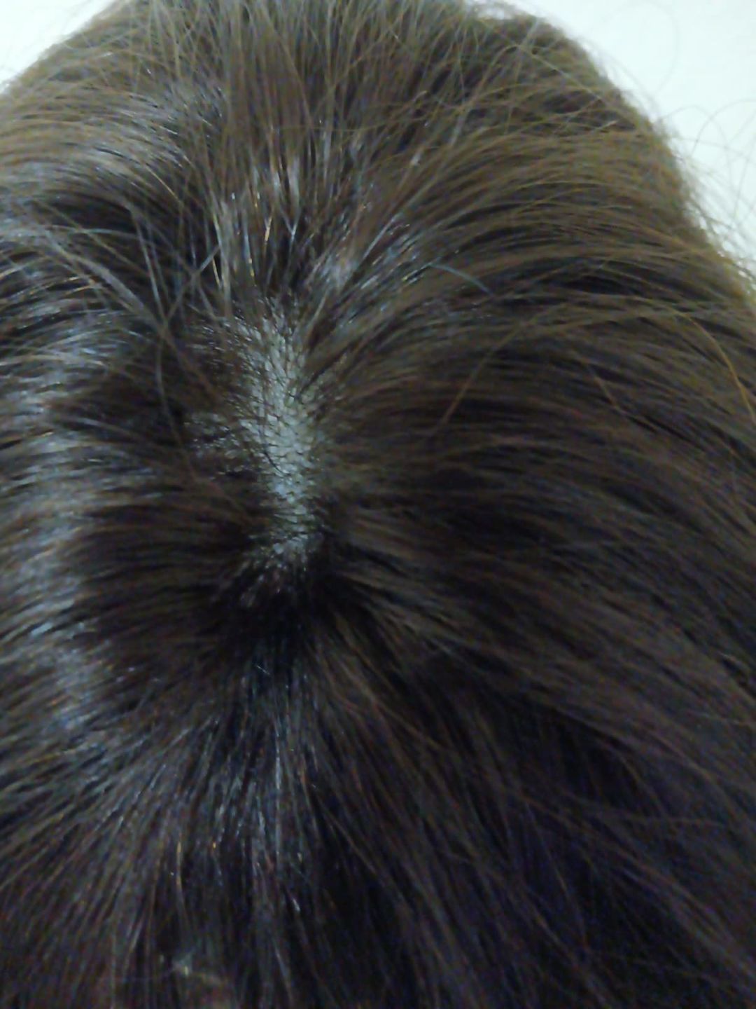 Customer photo review of Natural Black Human Hair Topper for Women with Thinning Hair #1B