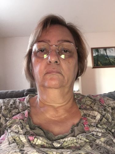 Customer photo review of Good Hair Vitamins Boost - 1 mois