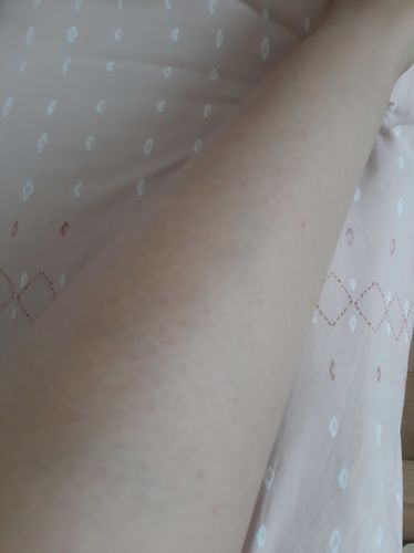 Customer photo review of Depilador Nuva Skin®
