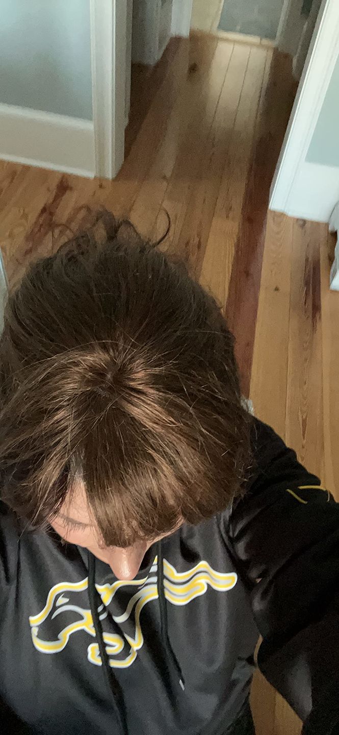Customer photo review of Full Coverage Dark Brown Human Hair Topper for Women Fine Hair #2