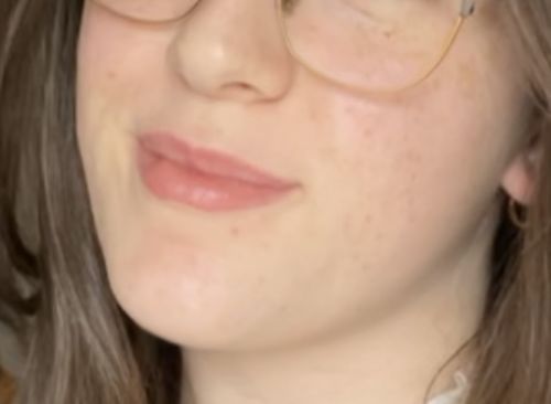 Customer photo review of Sleek Skin Serum 30ml