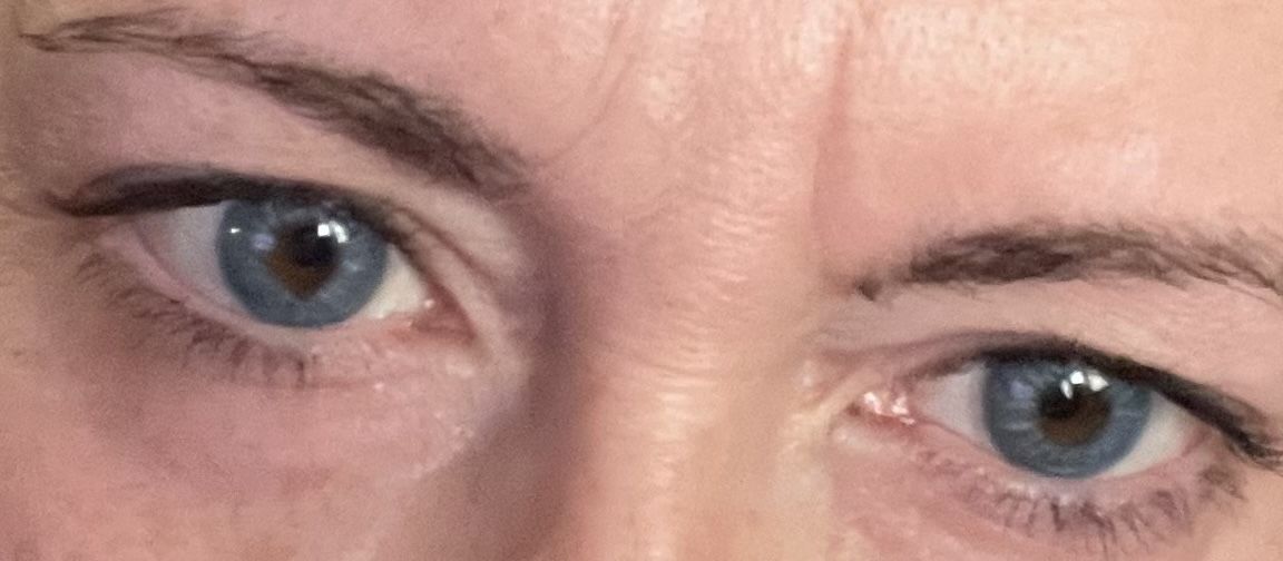 Customer photo review of Love Story Oxytocin Blue Prescription Coloured Contact Lenses