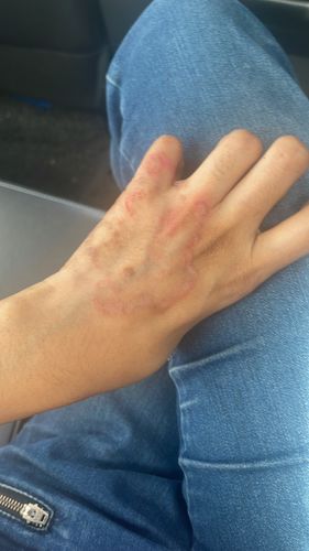 Customer photo review of Jolicare Cream