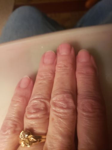 Customer photo review of Rocket Nail Fuel Starter Kit