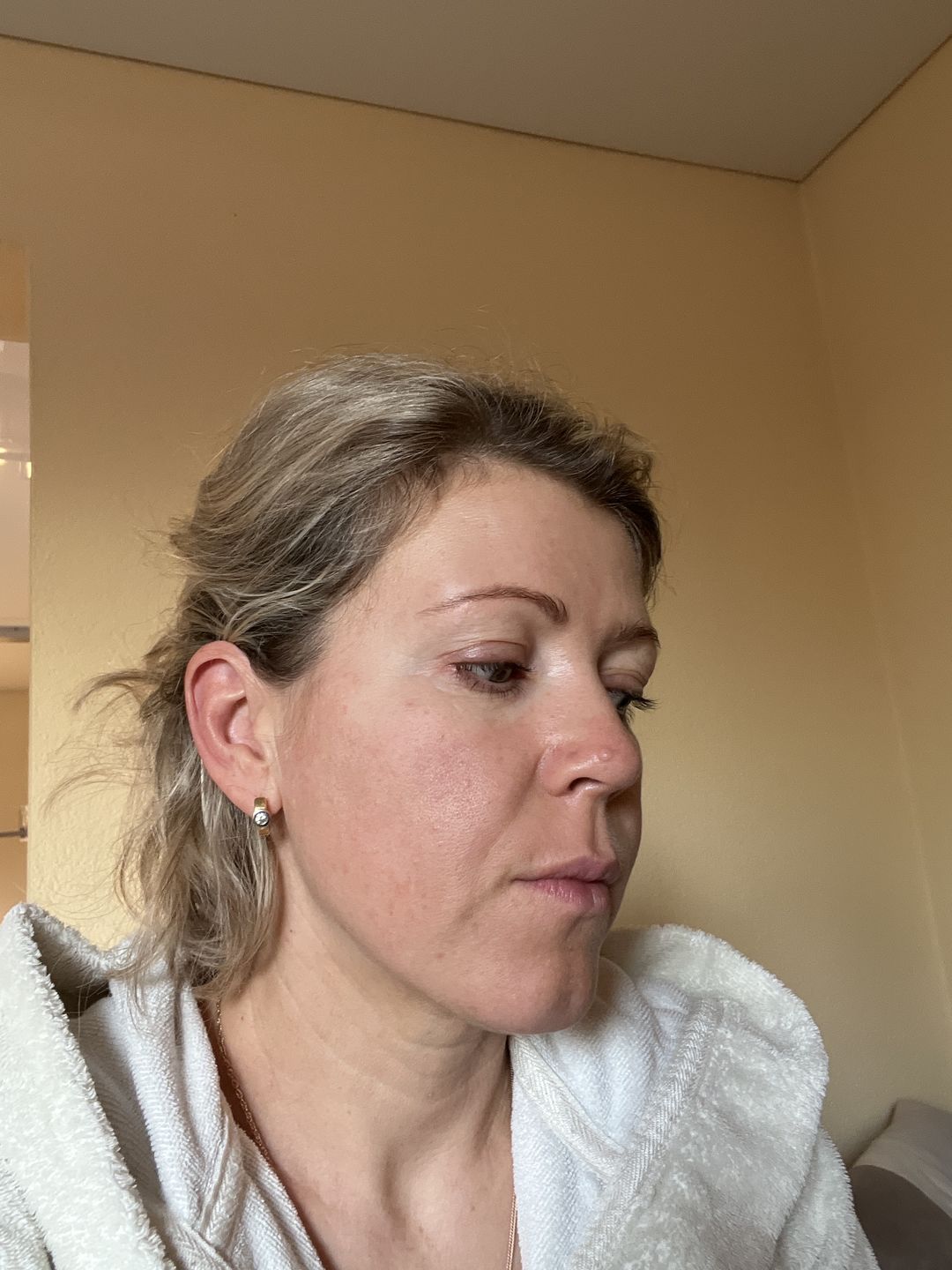 Customer photo review of Spa Treatment iSheet HAS Stem Cell Complex Eye Mask