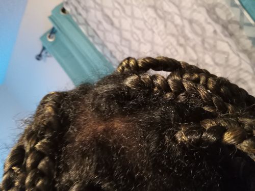 Customer photo review of Rice Water Scalp Mist (PreMade)