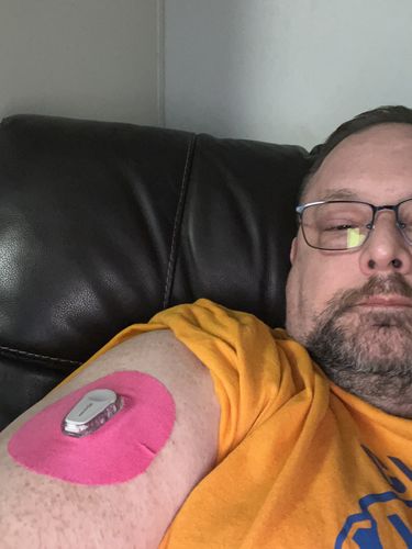 Customer photo review of Skin Grip Original - Dexcom G6 Patches