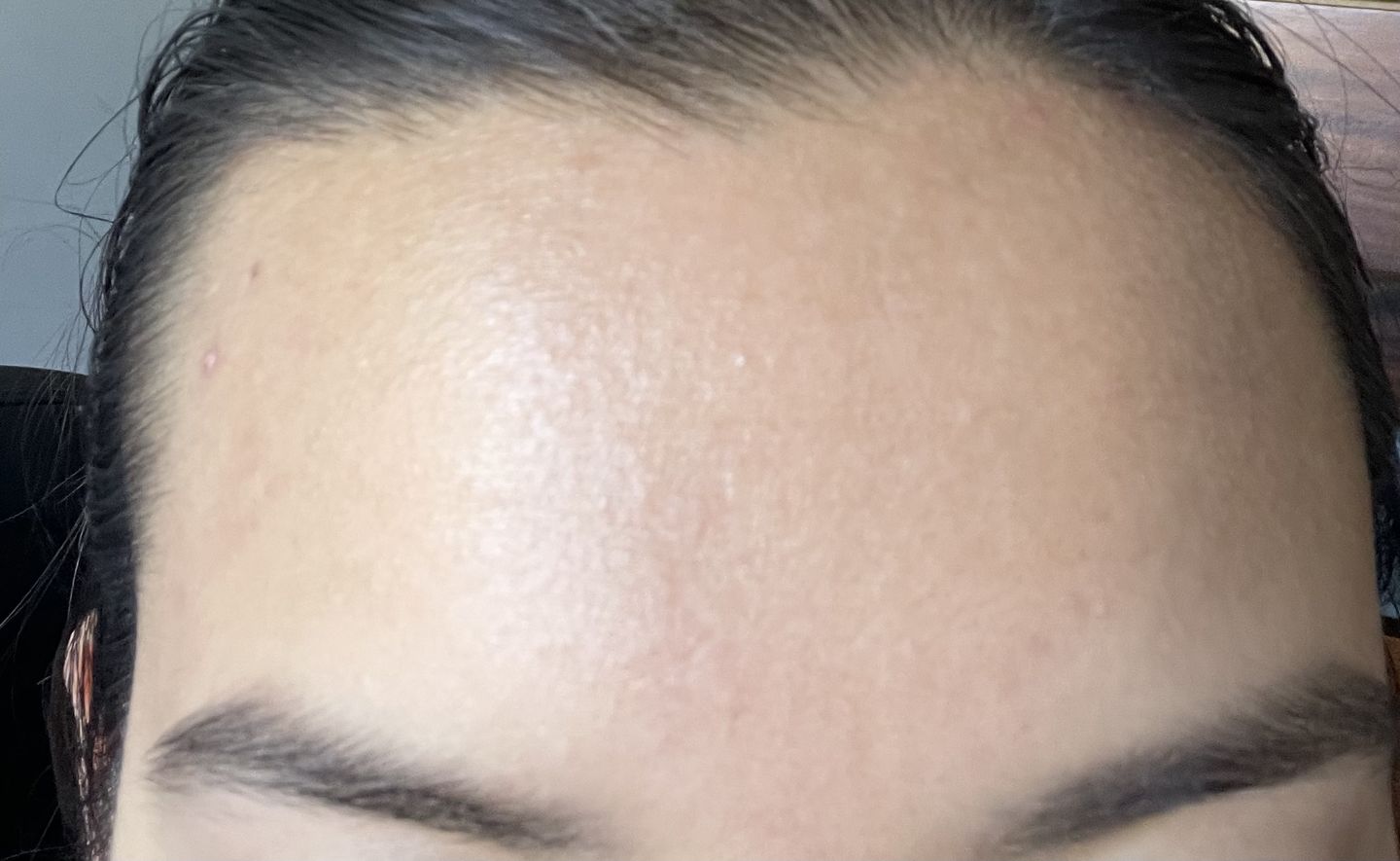 Customer photo review of Advanced Snail 96 Mucin Power Essence 100ml