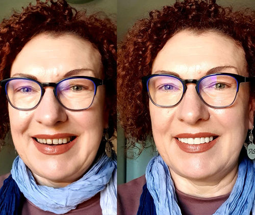 Customer photo review of Teeth-Veneer 2.0