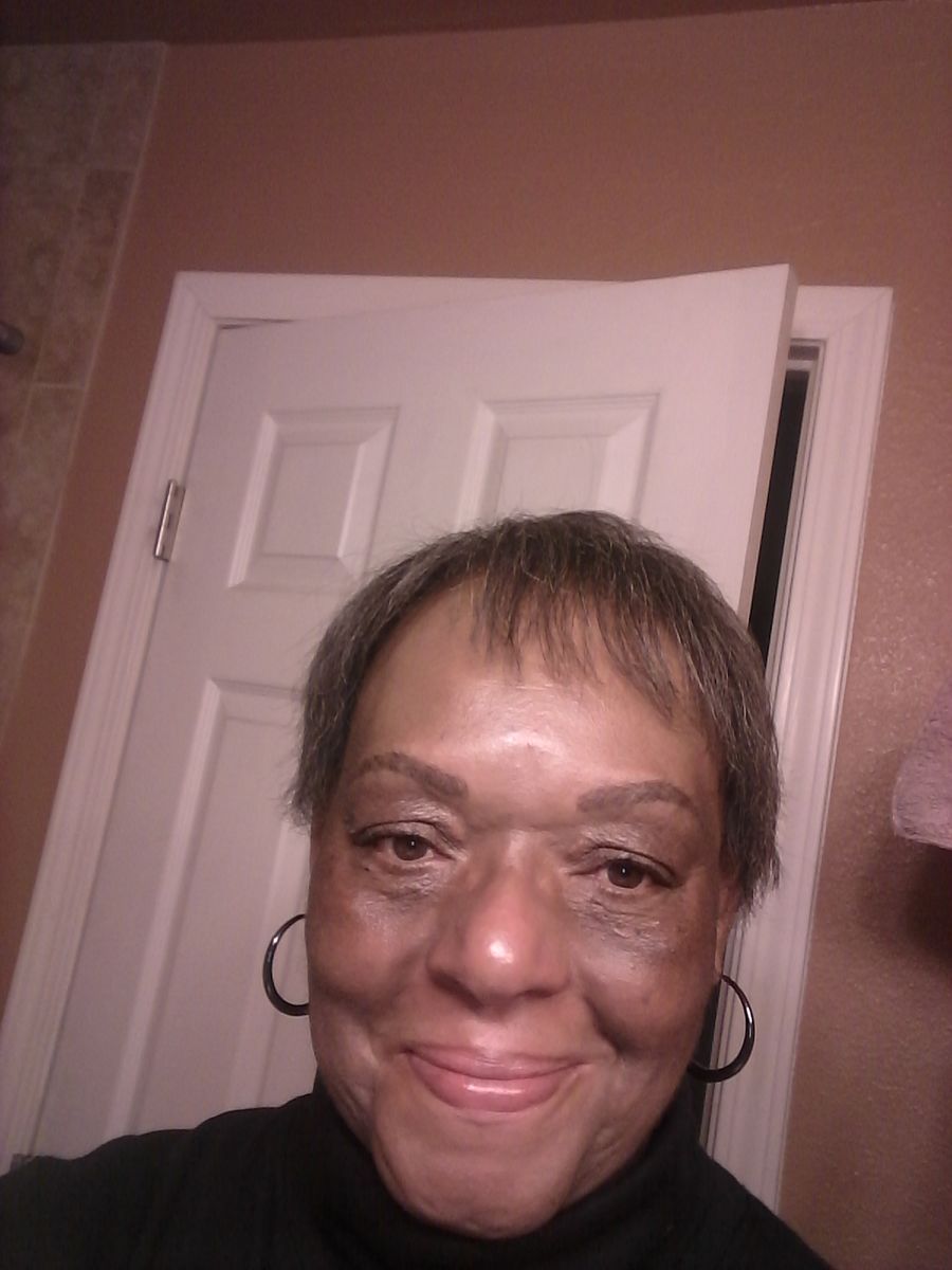 Customer photo review of Bolden Dark Spot Fix