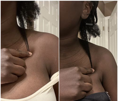 Customer photo review of Rice Water Scalp Mist (PreMade)