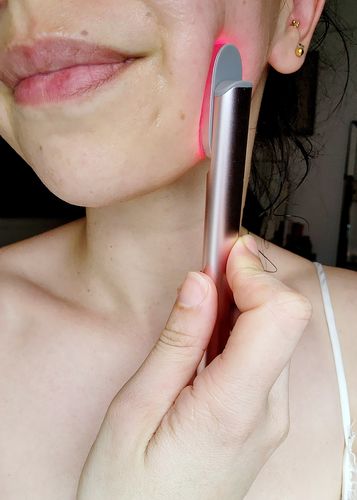 Customer photo review of 4-in-1 LED Facial Wand