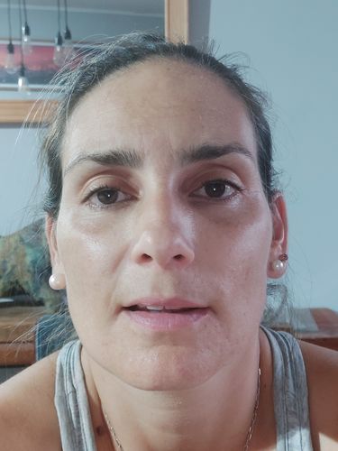 Customer photo review of Pack rostro: Hidro-K Día, Hidro-K Noche, Realiv