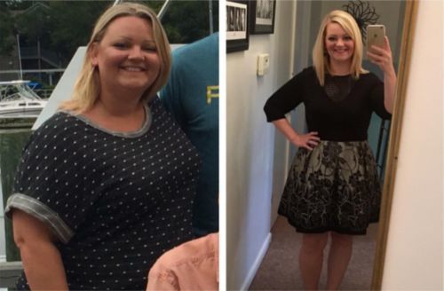 Customer photo review of Perfect Detox Slimming Patch(Limited Time Discount 🔥 Last Day)