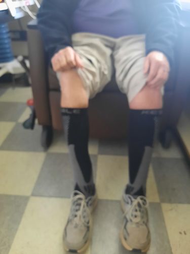 Customer photo review of High Graduated Compression Socks 20-30mmHg (Pack of 2)