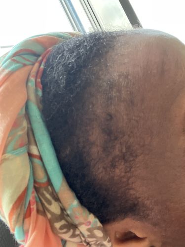 Customer photo review of TRÈS[S] GROWN - Hair Growth Serum