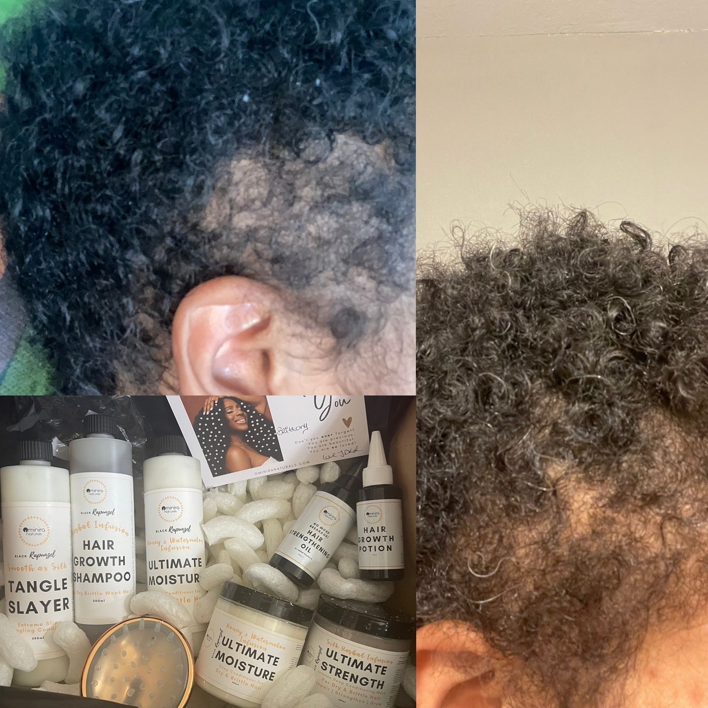 Customer photo review of Hair Recovery Bundle