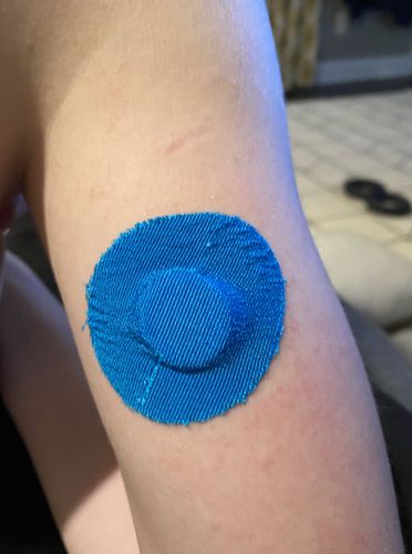 Customer photo review of Skin Grip Original - Freestyle Libre 3 Adhesive Patches