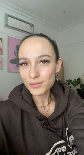 Customer photo review of LOVESKIN Acne/ Combination Skincare Ritual