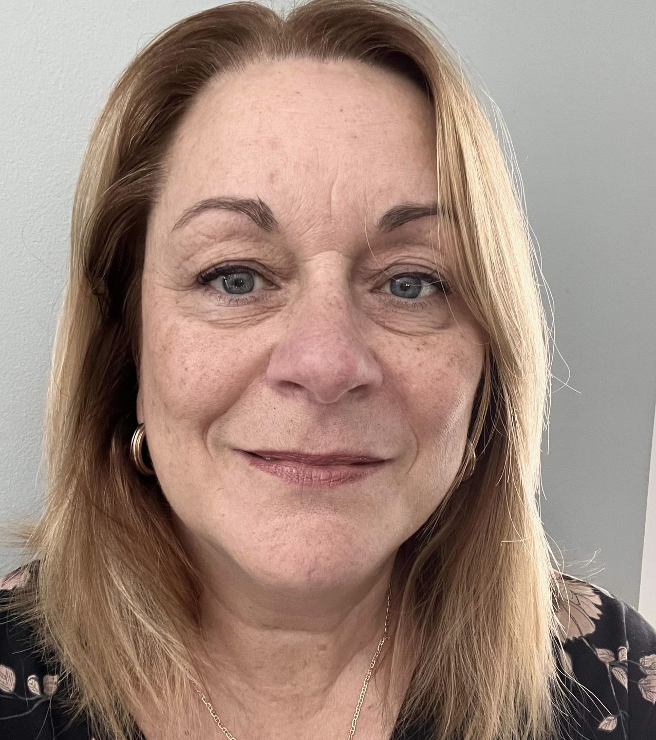 Customer photo review of Laser Forfait