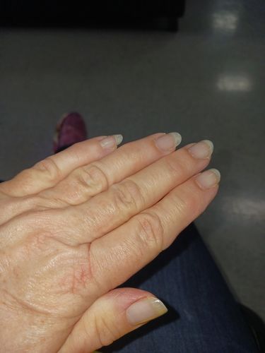 Customer photo review of Rocket Nail Fuel Starter Kit