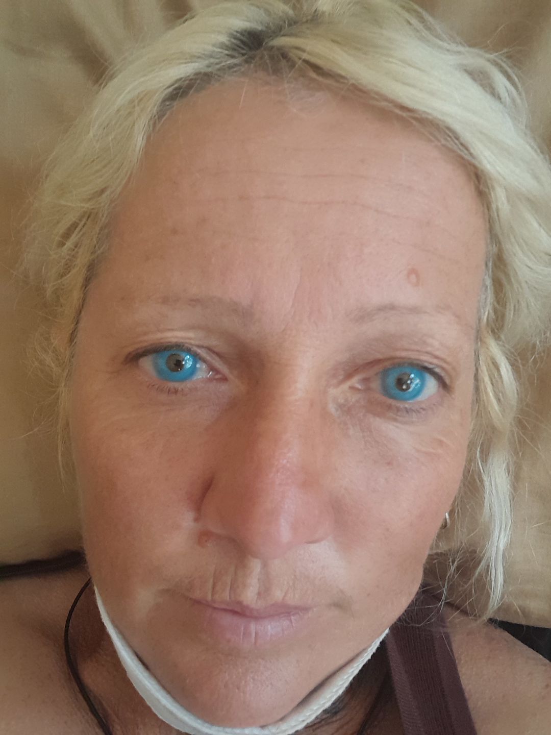 Customer photo review of Pixie Blue Prescription Coloured Contact Lenses