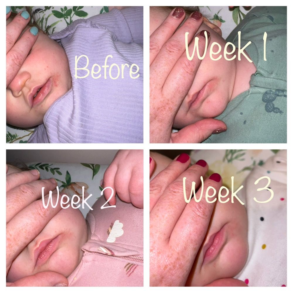 Customer photo review of Baby Face Cream