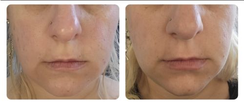 Customer photo review of Vitamine C 11%