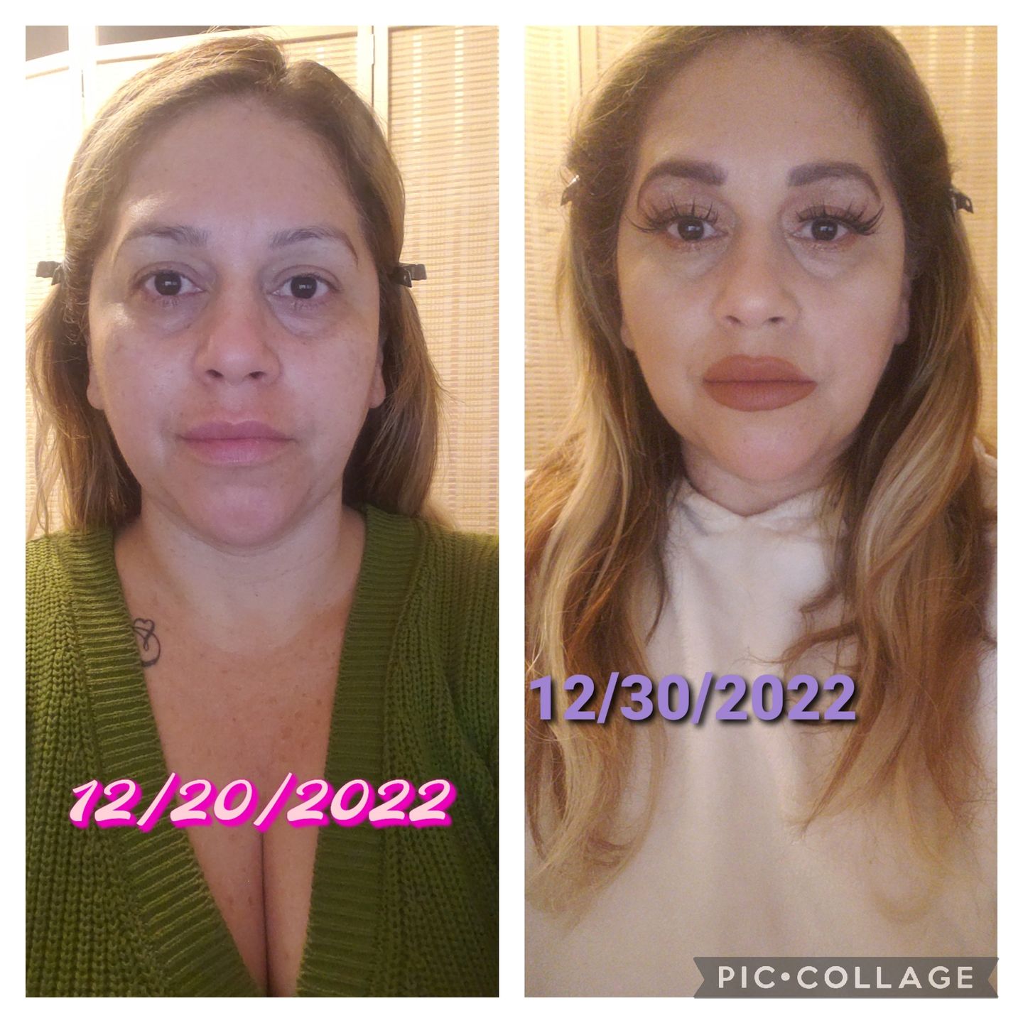 Customer photo review of AHA Facial Toner 🌿 With Lavender