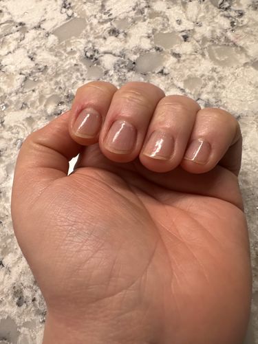 Customer photo review of Route Package Protection