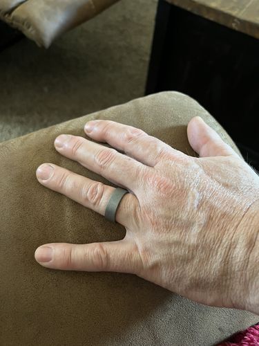 Customer photo review of Ring Exchange