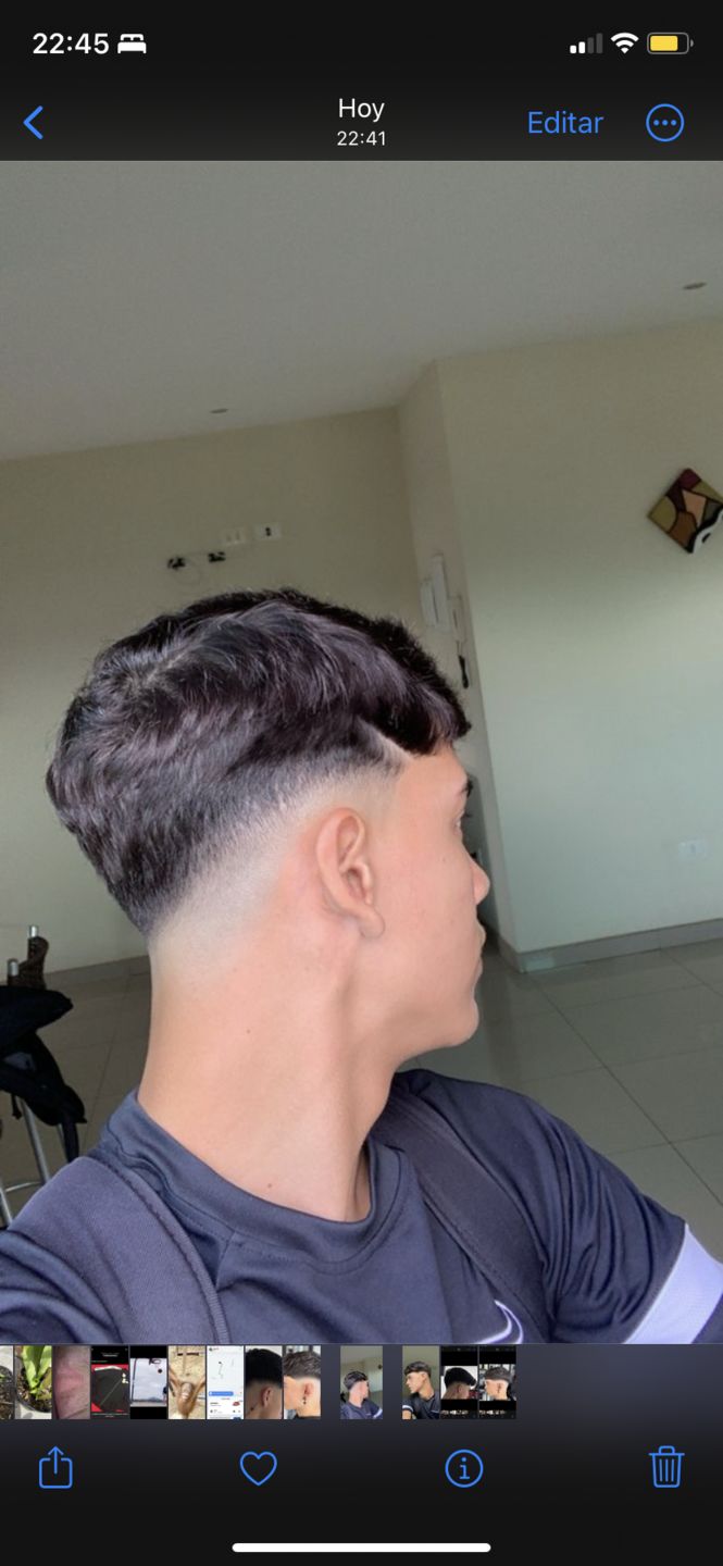 Customer photo review of Kit Adiós Alopecia
