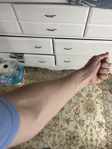 Customer photo review of GripXT™ - Grip Strengtheners 2.0