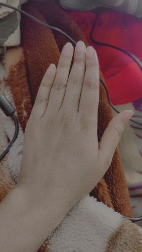 Customer photo review of Hand & Foot Glowing CREAM 🦶✋ Formulated With Multi-Vitamins & Glowing Agents, Moisturizes, Soothes & Improves Skin Texture, Makes Skin Soft & Glowing