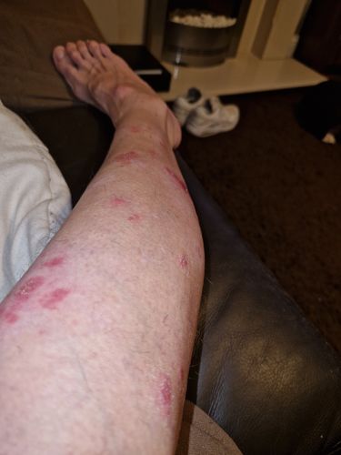 Customer photo review of Multi Strain Biotic