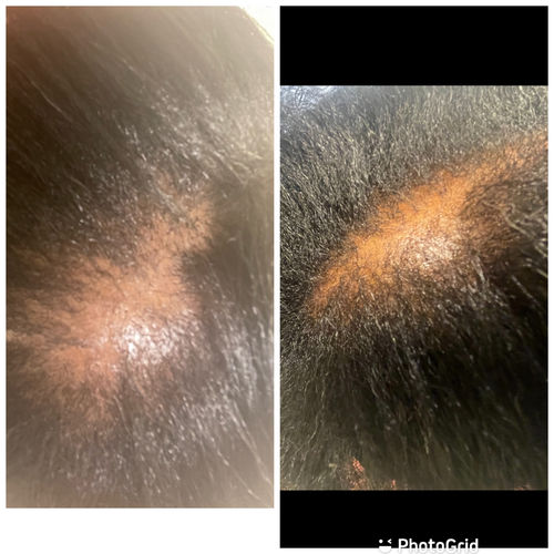 Customer photo review of India’s Secret Ancient Ayurvedic Hair Follicle Elixir (4 sizes)