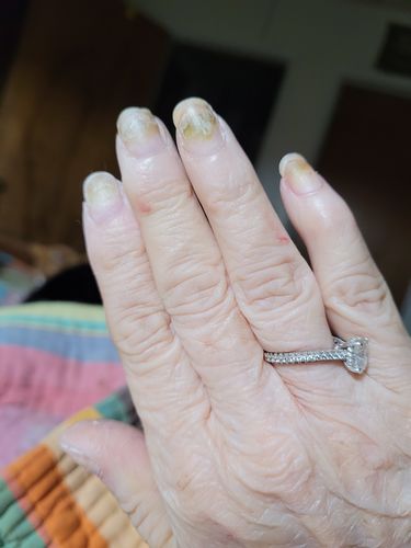 Customer photo review of Route Package Protection