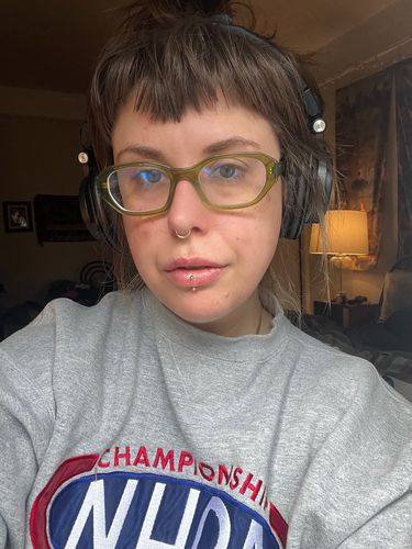 Customer photo review of LipFix: Filler