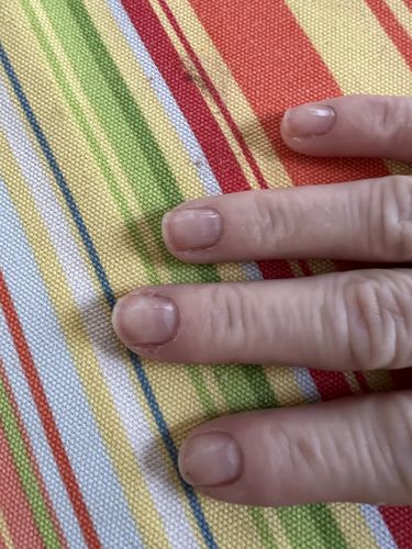 Customer photo review of Route Package Protection