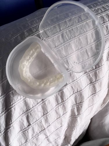 Customer photo review of SleepPro Standard Night Guard 3mm