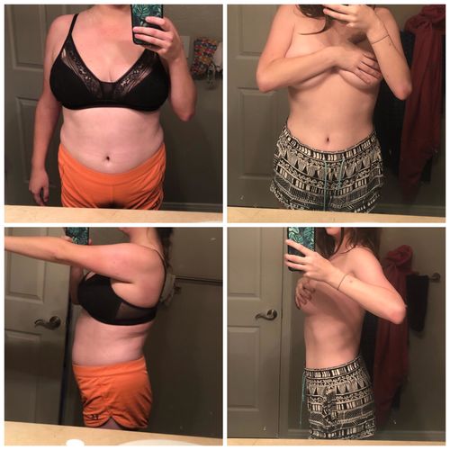 Customer photo review of Hot sale - Natural Belly Drainage Ginger Oil