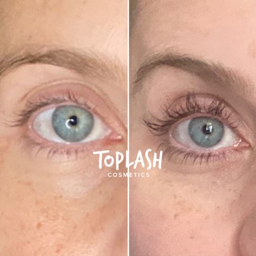 Customer photo review of Toplash eyelash and eyebrow growth serum — 3ml
