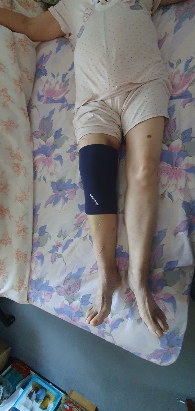 Customer photo review of COCOON KNEE FLEX PRO