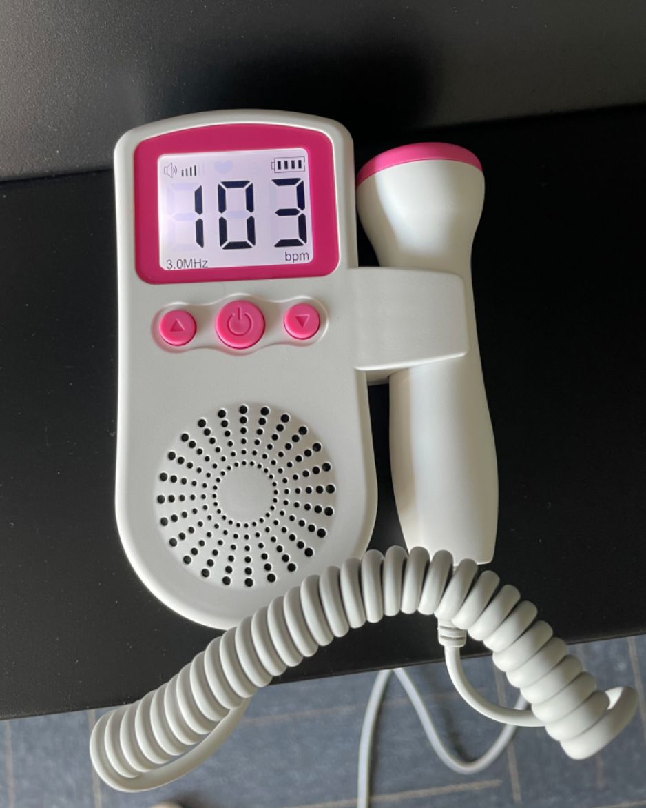 Customer photo review of Doppler foetal