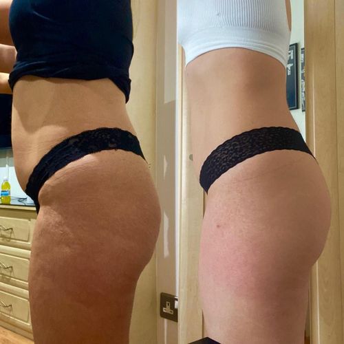 Customer photo review of Hot sale - Natural Belly Drainage Ginger Oil