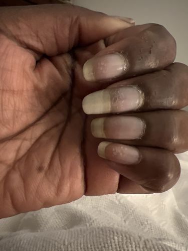 Customer photo review of Rocket Nail Fuel Starter Kit