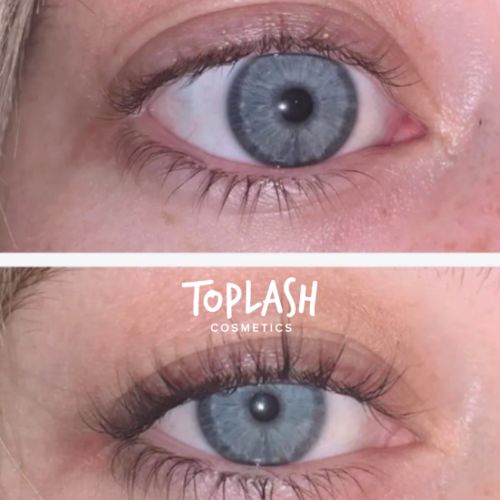 Customer photo review of Toplash eyelash and eyebrow growth serum — 3ml