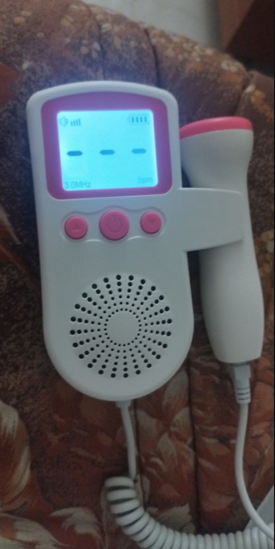 Customer photo review of Doppler foetal